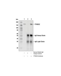 Cell Signaling Ythdc2 Antibody