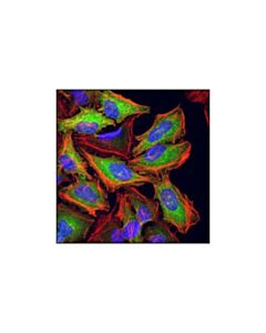 Cell Signaling Tgm2 (D11a6) Xp Rabbit mAb