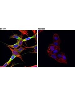 Cell Signaling Crmp-2 (D8l6v) Rabbit mAb