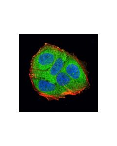 Cell Signaling Ldha (C4b5) Rabbit mAb