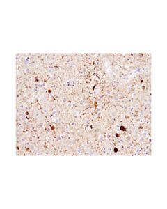 Cell Signaling Phospho-Tau (Ser404) (D2z4g) Rabbit mAb (Ihc Preferred)