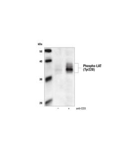 Cell Signaling Phospho-Lat (Tyr220) Antibody