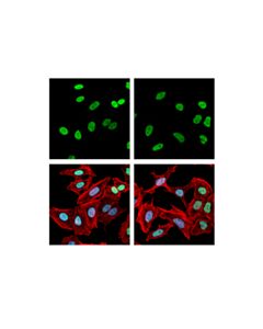 Cell Signaling Rpa32/Rpa2 (E8x5p) Xp Rabbit mAb