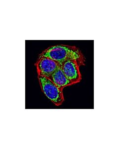 Cell Signaling Grp75 (D13h4) Xp Rabbit mAb