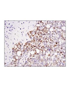 Cell Signaling Dnmt3a (D23g1) Rabbit mAb