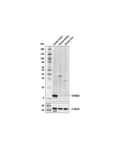 Cell Signaling S100a7 Antibody