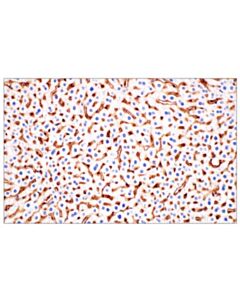Cell Signaling Cd47 (E2v9v) Rabbit mAb
