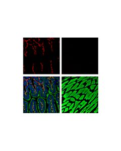 Cell Signaling Alpha-Smooth Muscle Actin (D4k9n) Xp Rabbit mAb (Alexa Fluor 594 Conjugate)