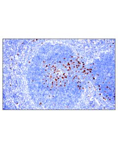 Cell Signaling Il-2ralpha/Cd25 (E4b2z) Xp Rabbit mAb