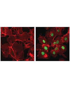 Cell Signaling Hif-1alpha (D1s7w) Xp<LT/>Sup&Gt;®<LT/>/Sup&Gt; Rabbit mAb