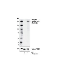 Cell Signaling Phospho-Tuberin/Tsc2 (Thr1462) (5b12) Rabbit mAb