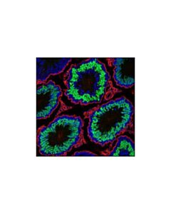Cell Signaling Nut (C52b1) Rabbit mAb