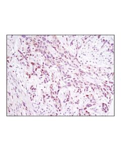 Cell Signaling Nfat1 (D43b1) Xp Rabbit mAb (BSA And Azide Free)
