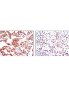 Cell Signaling Alk (D5f3<LT/>Sup&Gt;®<LT/>/Sup&Gt;) Xp<LT/>Sup&Gt;®<LT/>/Sup&Gt; Rabbit mAb