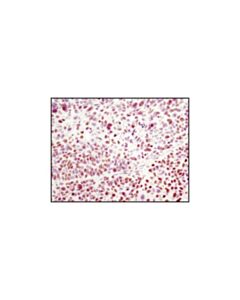 Cell Signaling Histone H2a (L88a6) Mouse mAb