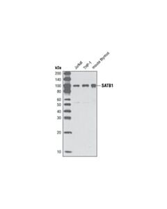 Cell Signaling Satb1 (P472) Antibody