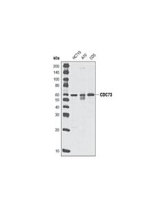 Cell Signaling Cdc73 (A264) Antibody