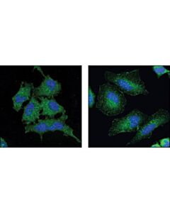 Cell Signaling Wave-2 (D2c8) Xp Rabbit mAb