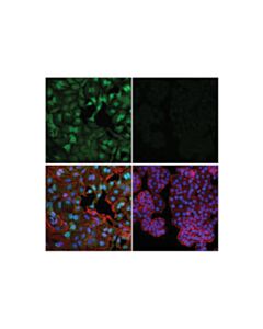 Cell Signaling Anti-Glucocorticoid Receptor Xp Antibody, 100 Ul Net Content, Monoclonal, Rabbit Host Species