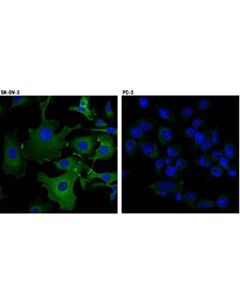 Cell Signaling Alpha-E-Catenin (D9r5e) Rabbit mAb