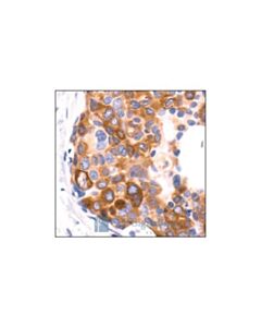 Cell Signaling Phospho-Acetyl-Coa Carboxylase (Ser79) Antibody