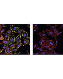 Cell Signaling Phospho-Myosin Light Chain 2 (Ser19) Antibody
