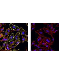 Cell Signaling Phospho-Myosin Light Chain 2 (Ser19) Antibody
