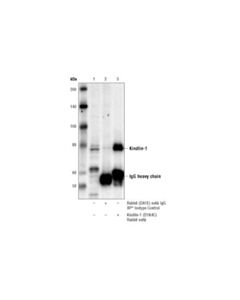 Cell Signaling Kindlin-1 (D1k4c) Rabbit mAb