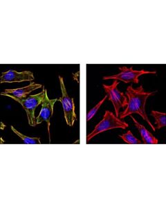 Cell Signaling Phospho-Myosin Light Chain 2 (Ser19) Mouse mAb