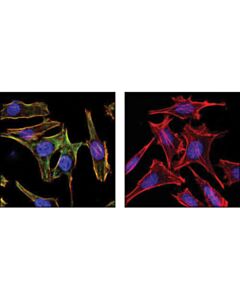 Cell Signaling Phospho-Myosin Light Chain 2 (Ser19) Mouse mAb
