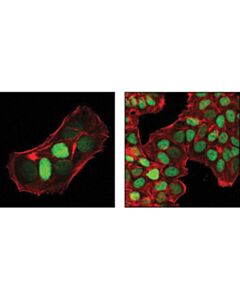 Cell Signaling P27 Kip1 (D69c12) Xp Rabbit mAb