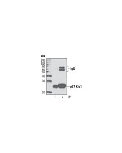 Cell Signaling P27 Kip1 (D37h1) Rabbit mAb