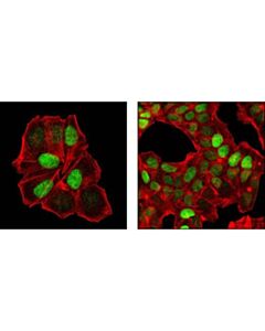 Cell Signaling P27 Kip1 (Sx53g8.5) Mouse mAb