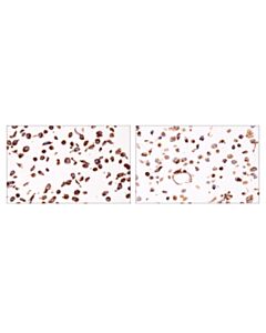 Cell Signaling Shmt2 (E8o8j) Rabbit mAb (Ihc Specific)