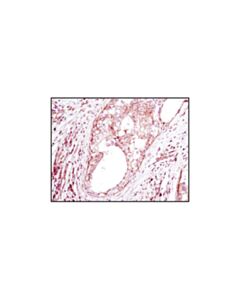 Cell Signaling Beta-Actin (8h10d10) Mouse mAb