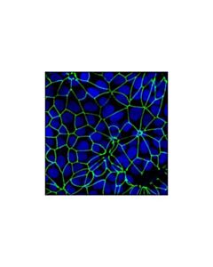 Cell Signaling Zo-3 (D57g7) Xp Rabbit mAb