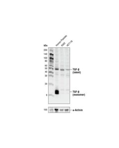 Cell Signaling Tgf-Beta Antibody