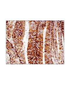 Cell Signaling Cd44 (E7k2y) Xp Rabbit mAb