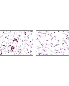 Cell Signaling Sox2 (C70b1) Rabbit mAb (Ihc Preferred)