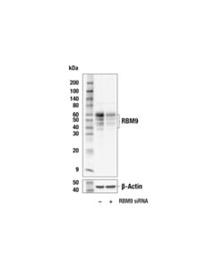 Cell Signaling Rbm9 (E7w6u) Rabbit mAb