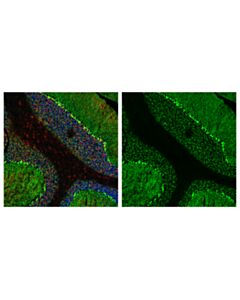 Cell Signaling Gat1 (E7j1b) Rabbit mAb