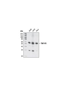 Cell Signaling Tnf-R1 (C25c1) Rabbit mAb
