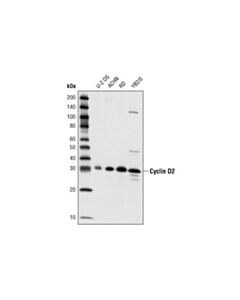 Cell Signaling Cyclin D2 (D52f9) Rabbit mAb
