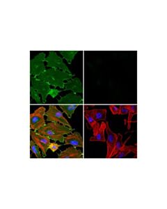 Cell Signaling Beta-Catenin (15b8) Mouse mAb