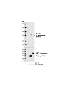 Cell Signaling Phospho-5-Lipoxygenase (Ser663) Antibody