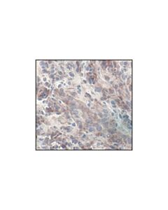 Cell Signaling Phospho-Akt (Ser473) (736e11) Rabbit mAb