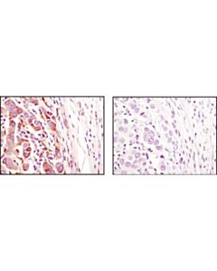 Cell Signaling Erp44 (D17a6) Xp Rabbit mAb