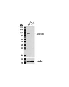 Cell Signaling Cd105/Endoglin (3a9) Mouse mAb (BSA And Azide Free)