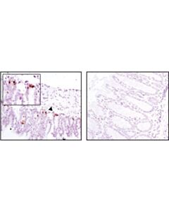 Cell Signaling Mmp-7 (D4h5) Xp Rabbit mAb