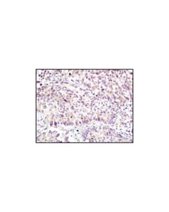 Cell Signaling Plexin A1 Antibody